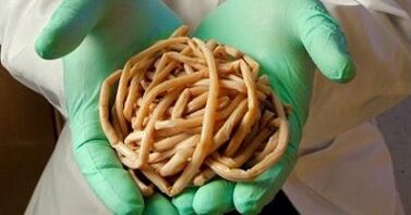 parasieten die uit het menselijk lichaam worden gehaald