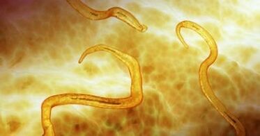 pinwormparasieten in het menselijk lichaam
