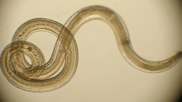 wormparasiet uit het menselijk lichaam