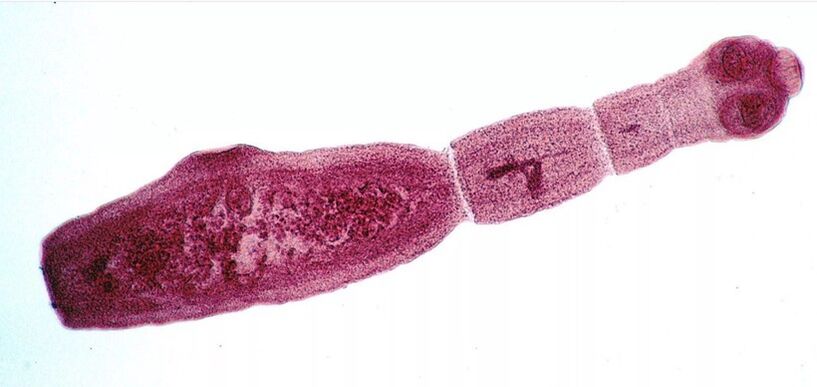 Echinococcus is een van de gevaarlijkste parasieten voor mensen