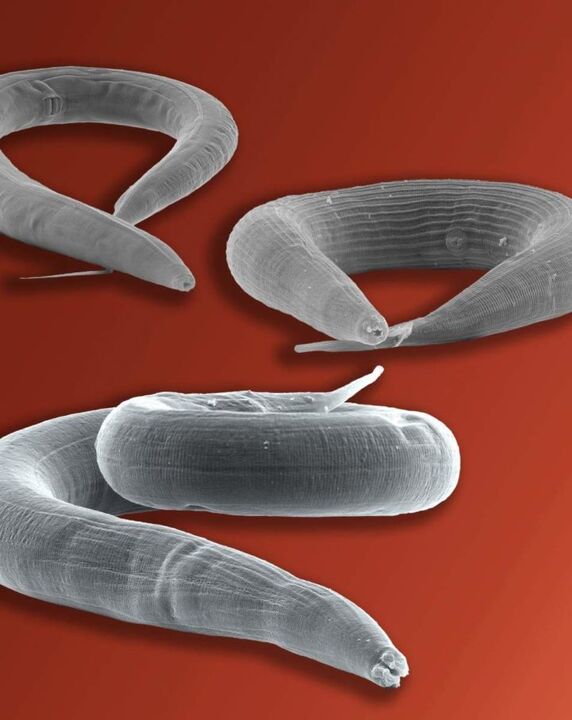 pinworm parasiet die in de darm leeft