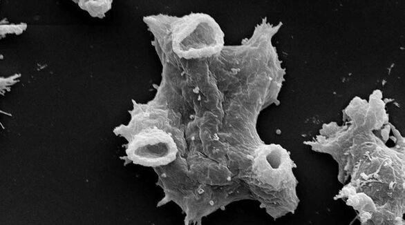 Negleria fowlera is een protozoaire parasiet die gevaarlijk is voor het menselijk leven. 