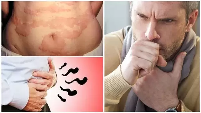 Allergieën, hoesten en een opgeblazen gevoel zijn tekenen van schade aan het lichaam door wormen