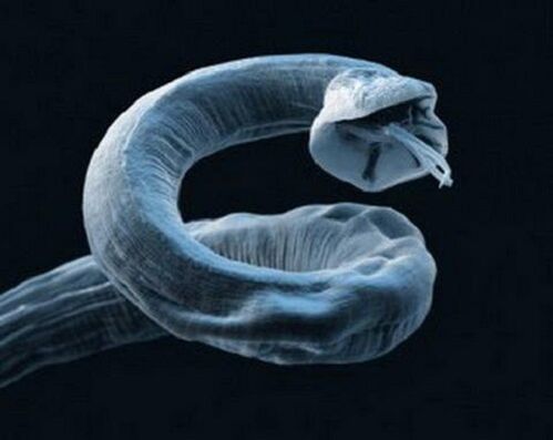 worm uit het menselijk lichaam hoe te verwijderen