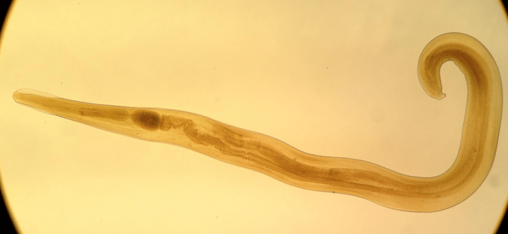 Pinworm is een veel voorkomende parasiet bij kinderen. 
